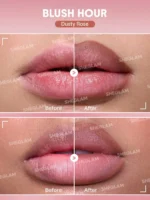 نتیجه استفاده از خط لب شیگلم