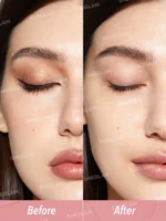 نتیجه استفاده از میسلار واتر شیگلم